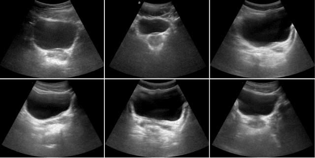 Figure 1 for Slim U-Net: Efficient Anatomical Feature Preserving U-net Architecture for Ultrasound Image Segmentation