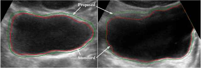 Figure 3 for Slim U-Net: Efficient Anatomical Feature Preserving U-net Architecture for Ultrasound Image Segmentation