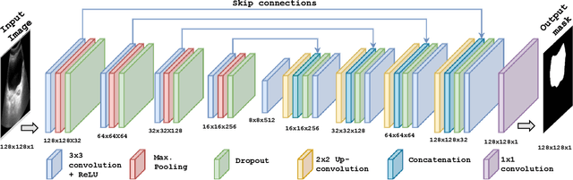 Figure 4 for Slim U-Net: Efficient Anatomical Feature Preserving U-net Architecture for Ultrasound Image Segmentation