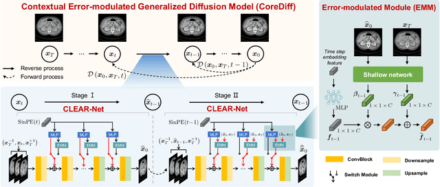 Figure 1 for CoreDiff: Contextual Error-Modulated Generalized Diffusion Model for Low-Dose CT Denoising and Generalization