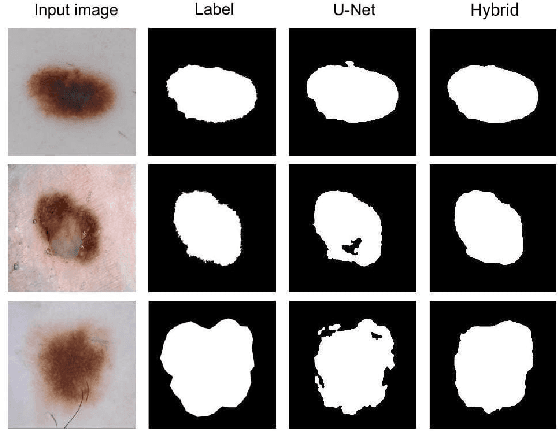 Figure 2 for A hybrid approach for improving U-Net variants in medical image segmentation