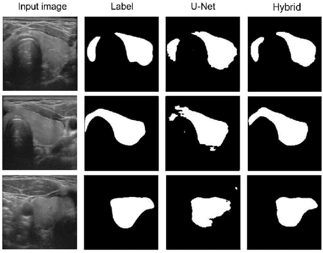 Figure 3 for A hybrid approach for improving U-Net variants in medical image segmentation