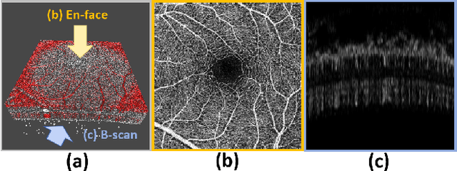 Figure 3 for SAM-OCTA: Prompting Segment-Anything for OCTA Image Segmentation