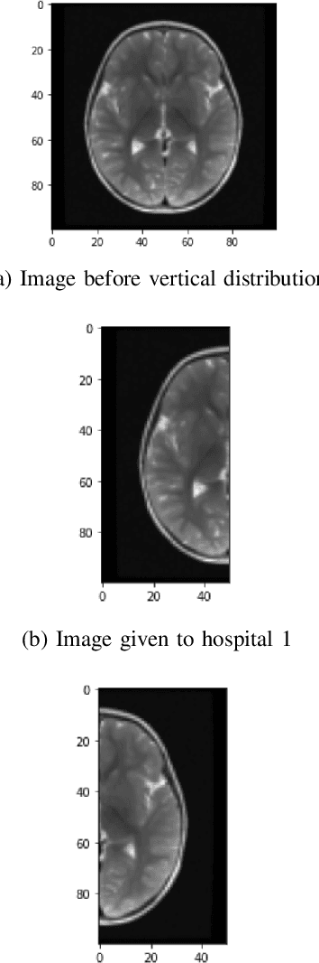 Figure 3 for Multi-limb Split Learning for Tumor Classification on Vertically Distributed Data