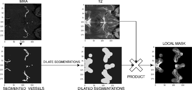 Figure 1 for Learned Local Attention Maps for Synthesising Vessel Segmentations