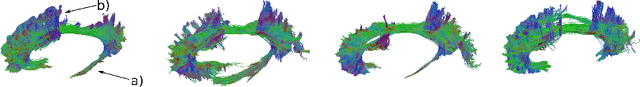 Figure 3 for Anisotropic Fanning Aware Low-Rank Tensor Approximation Based Tractography