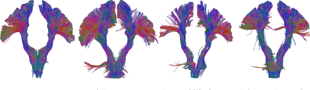Figure 4 for Anisotropic Fanning Aware Low-Rank Tensor Approximation Based Tractography