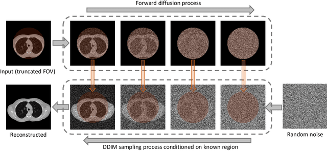 Figure 1 for Zero-shot CT Field-of-view Completion with Unconditional Generative Diffusion Prior