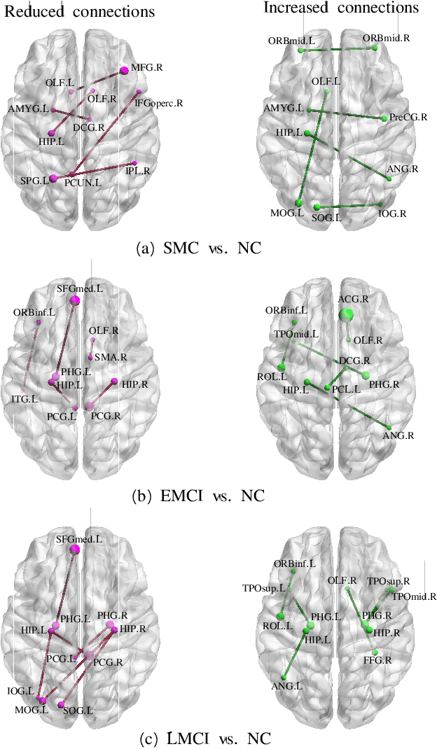 Figure 3 for Brain Structure-Function Fusing Representation Learning using Adversarial Decomposed-VAE for Analyzing MCI
