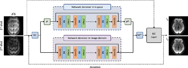 Figure 1 for Improved Multi-Shot Diffusion-Weighted MRI with Zero-Shot Self-Supervised Learning Reconstruction