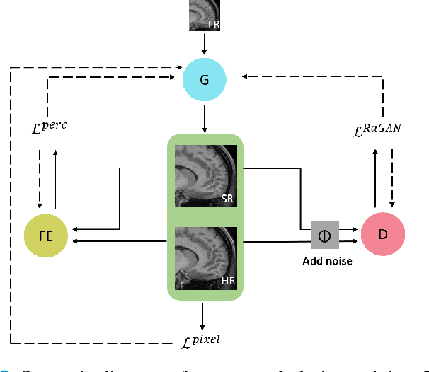 Figure 2 for A Three-Player GAN for Super-Resolution in Magnetic Resonance Imaging