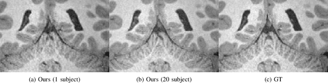 Figure 3 for A Three-Player GAN for Super-Resolution in Magnetic Resonance Imaging