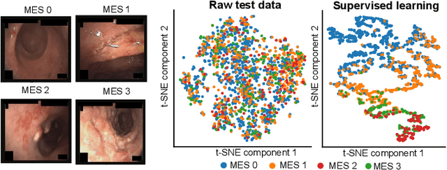 Figure 1 for SSL-CPCD: Self-supervised learning with composite pretext-class discrimination for improved generalisability in endoscopic image analysis