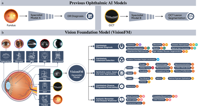 Figure 1 for VisionFM: a Multi-Modal Multi-Task Vision Foundation Model for Generalist Ophthalmic Artificial Intelligence