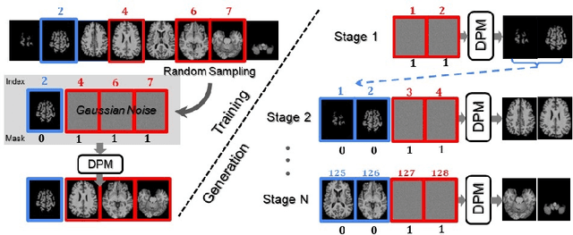 Figure 1 for Generating Realistic 3D Brain MRIs Using a Conditional Diffusion Probabilistic Model