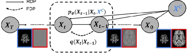 Figure 3 for Generating Realistic 3D Brain MRIs Using a Conditional Diffusion Probabilistic Model