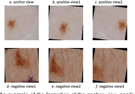 Figure 3 for GraVIS: Grouping Augmented Views from Independent Sources for Dermatology Analysis