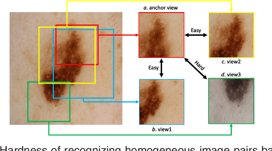 Figure 4 for GraVIS: Grouping Augmented Views from Independent Sources for Dermatology Analysis