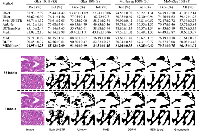 Figure 3 for Masked Diffusion as Self-supervised Representation Learner