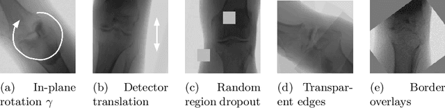 Figure 3 for Shape-based pose estimation for automatic standard views of the knee