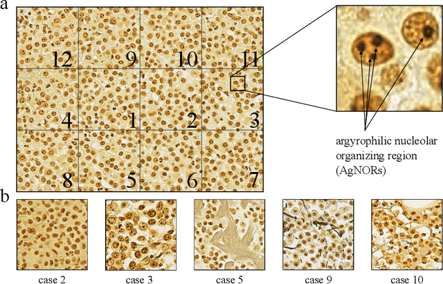 Figure 1 for Deep Learning-Based Automatic Assessment of AgNOR-scores in Histopathology Images