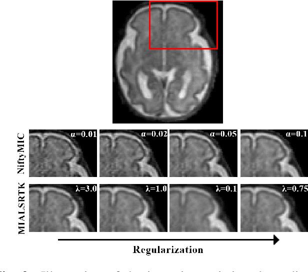 Figure 3 for Domain generalization in fetal brain MRI segmentation \\with multi-reconstruction augmentation
