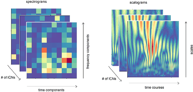 Figure 3 for A System for Differentiation of Schizophrenia and Bipolar Disorder based on rsfMRI