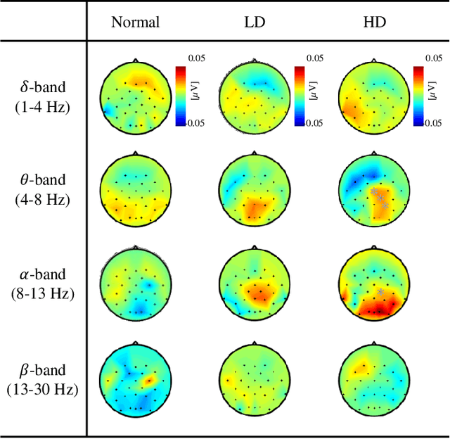 Figure 2 for Classification of Distraction Levels Using Hybrid Deep Neural Networks From EEG Signals