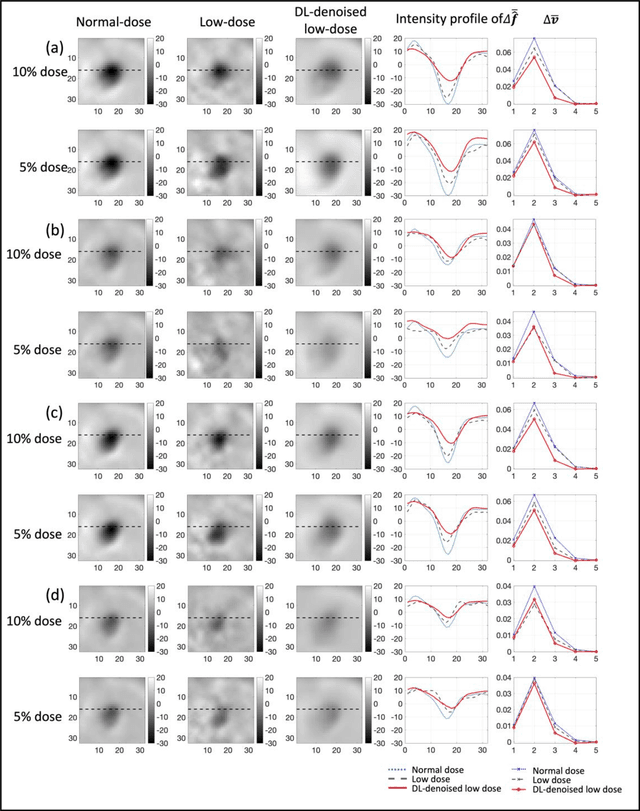 Figure 4 for Need for Objective Task-based Evaluation of Deep Learning-Based Denoising Methods: A Study in the Context of Myocardial Perfusion SPECT