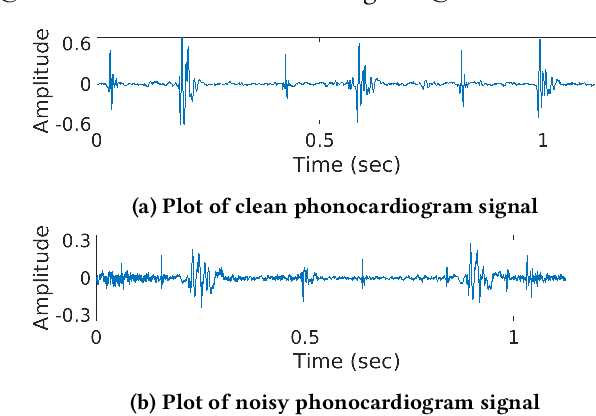 Figure 1 for A Novel U-Net Architecture for Denoising of Real-world Noise Corrupted Phonocardiogram Signal