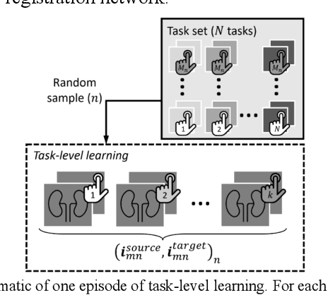 Figure 1 for Meta-Learning Initializations for Interactive Medical Image Registration