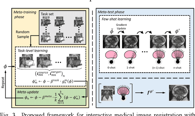 Figure 4 for Meta-Learning Initializations for Interactive Medical Image Registration