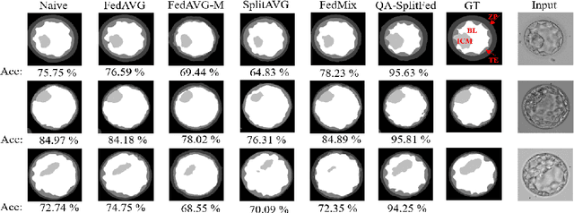 Figure 4 for Quality-Adaptive Split-Federated Learning for Segmenting Medical Images with Inaccurate Annotations