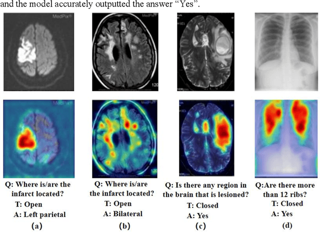Figure 4 for Masked Vision and Language Pre-training with Unimodal and Multimodal Contrastive Losses for Medical Visual Question Answering