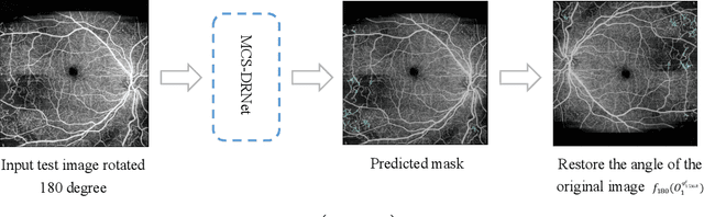 Figure 4 for Semi-Supervised Semantic Segmentation Methods for UW-OCTA Diabetic Retinopathy Grade Assessment