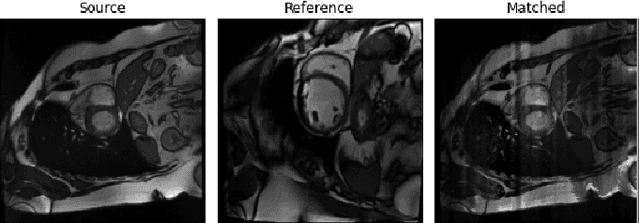 Figure 1 for Semi-Supervised Segmentation of Multi-vendor and Multi-center Cardiac MRI using Histogram Matching