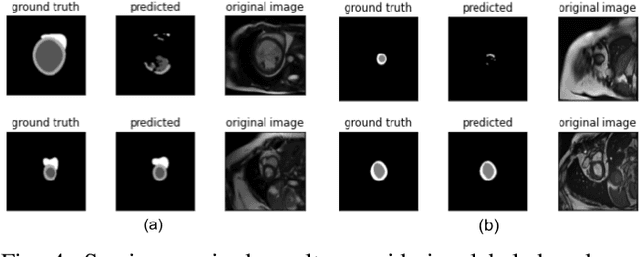 Figure 4 for Semi-Supervised Segmentation of Multi-vendor and Multi-center Cardiac MRI using Histogram Matching