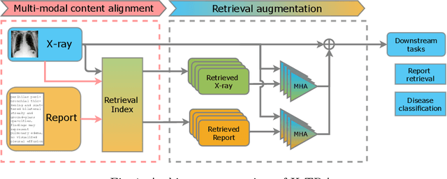 Figure 1 for X-TRA: Improving Chest X-ray Tasks with Cross-Modal Retrieval Augmentation