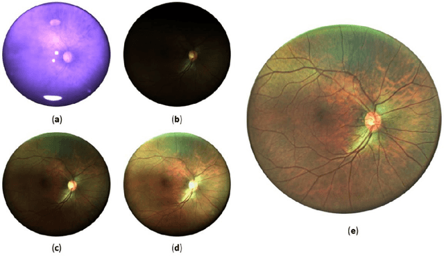 Figure 4 for A portable widefield fundus camera with high dynamic range imaging capability