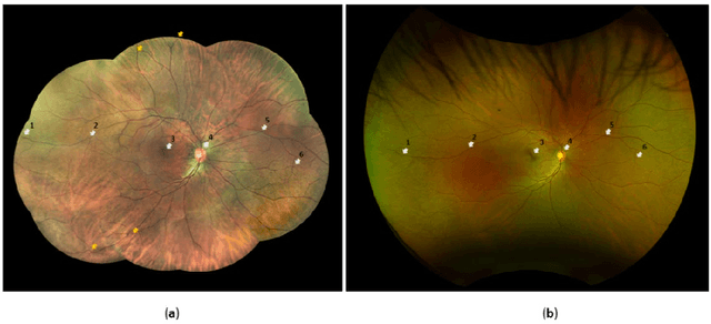 Figure 1 for A portable widefield fundus camera with high dynamic range imaging capability