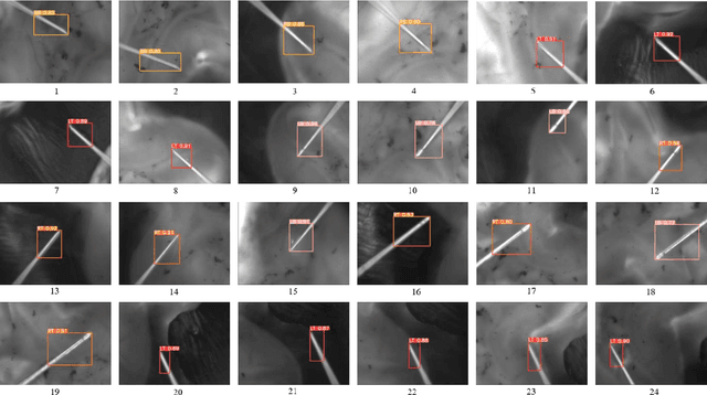 Figure 4 for The Neural Networks Based Needle Detection for Medical Retinal Surgery