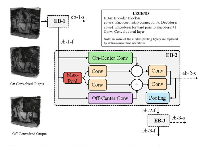 Figure 1 for IB-U-Nets: Improving medical image segmentation tasks with 3D Inductive Biased kernels