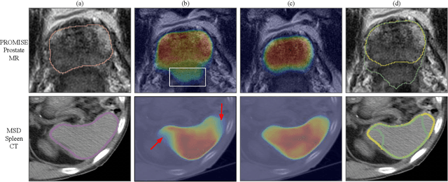 Figure 3 for IB-U-Nets: Improving medical image segmentation tasks with 3D Inductive Biased kernels