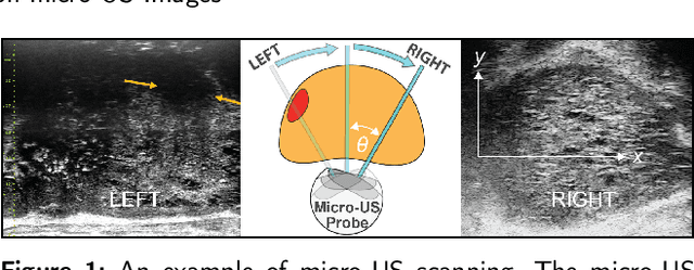 Figure 1 for MicroSegNet: A Deep Learning Approach for Prostate Segmentation on Micro-Ultrasound Images
