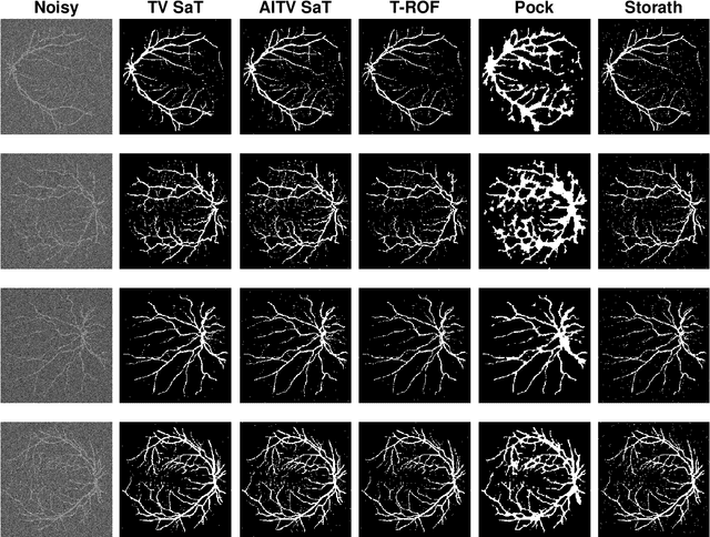 Figure 2 for Efficient Image Segmentation Framework with Difference of Anisotropic and Isotropic Total Variation for Blur and Poisson Noise Removal