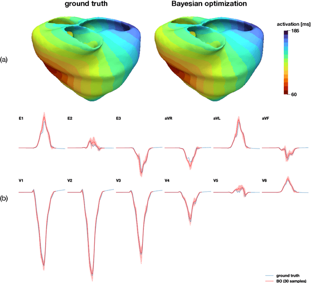Figure 4 for Probabilistic learning of the Purkinje network from the electrocardiogram