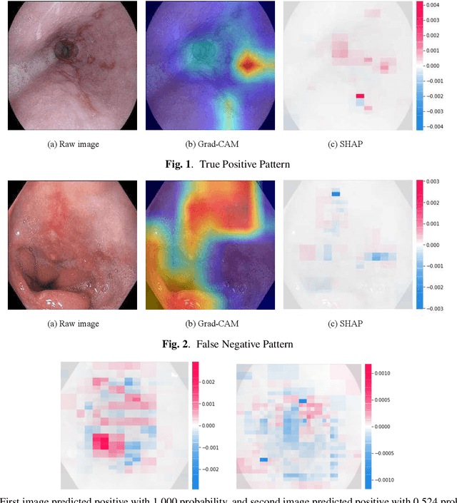 Figure 2 for Deep-learning models in medical image analysis: Detection of esophagitis from the Kvasir Dataset