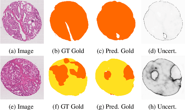 Figure 3 for Probabilistic Modeling of Inter- and Intra-observer Variability in Medical Image Segmentation