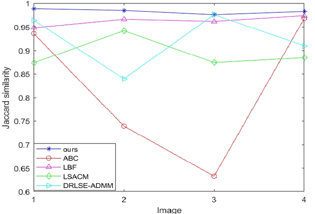 Figure 3 for Robust image segmentation model based on binary level set