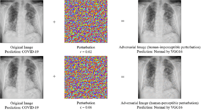 Figure 2 for Robust and Interpretable COVID-19 Diagnosis on Chest X-ray Images using Adversarial Training